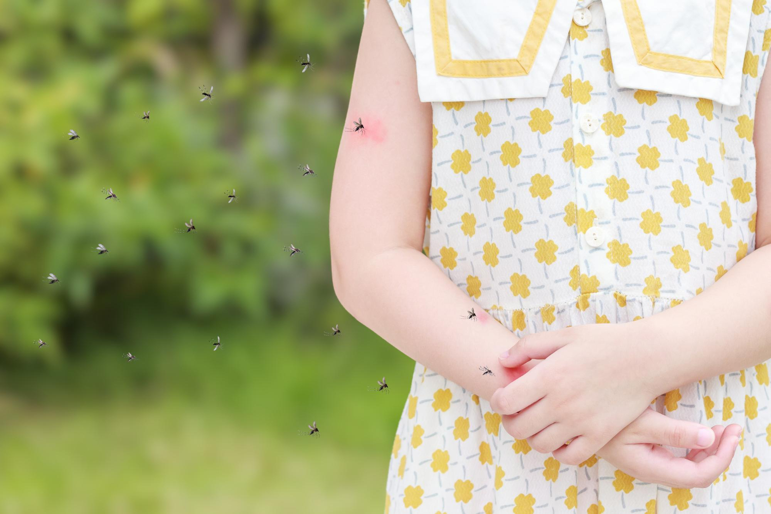 How to Treat Mosquito Bites on Babies