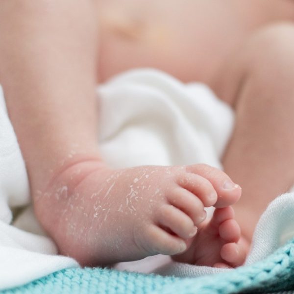 Protecting Your Little One’s Skin – Effective Dry Skin Toddler Remedies