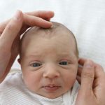 cradle-cap