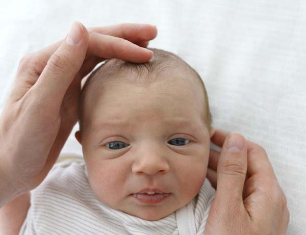 cradle-cap