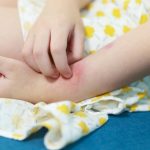 what-is-heat-rash-for-kids