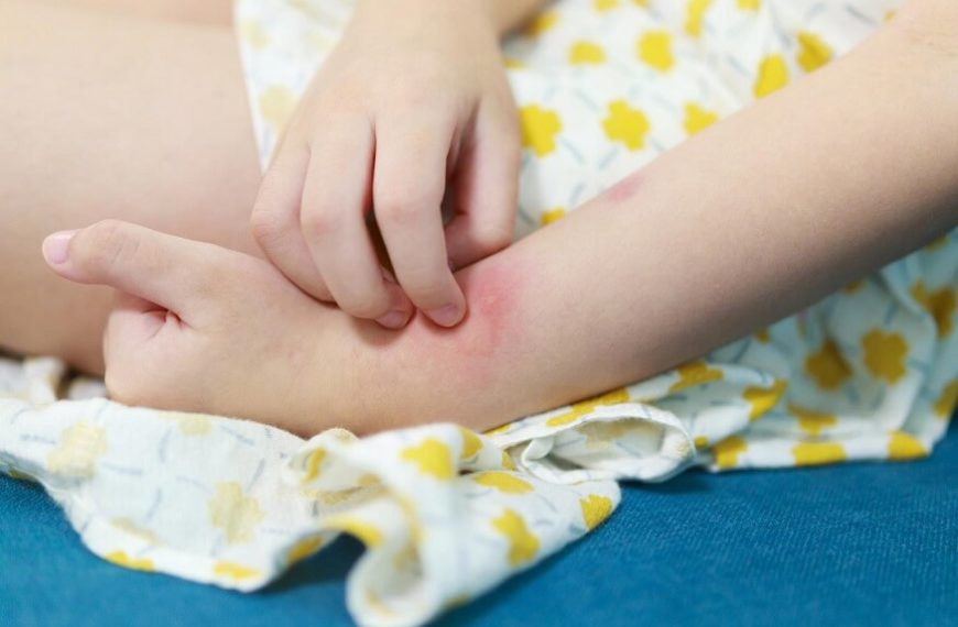 what-is-heat-rash-for-kids