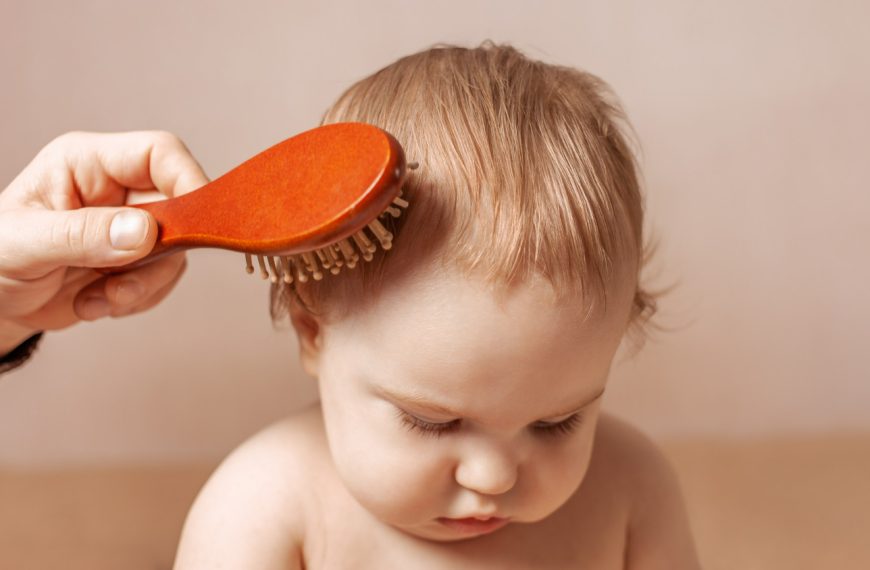 baby-hair-loss