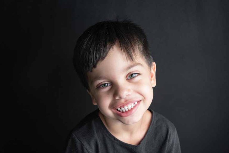 baby-teeth-discolouration