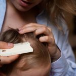 dry-itchy-scalp