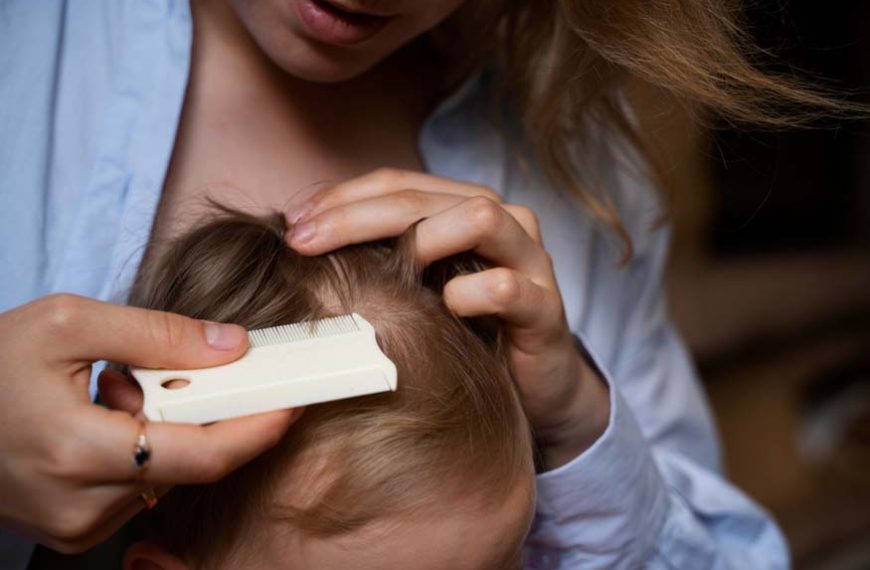 dry-itchy-scalp