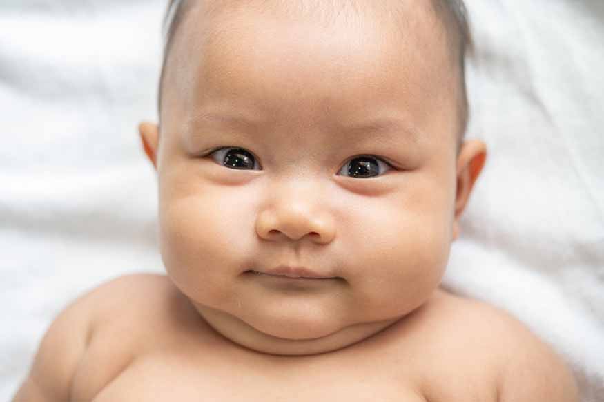 Understanding and Managing Plagiocephaly in Infants A Comprehensive Guide