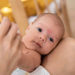 infant-acne