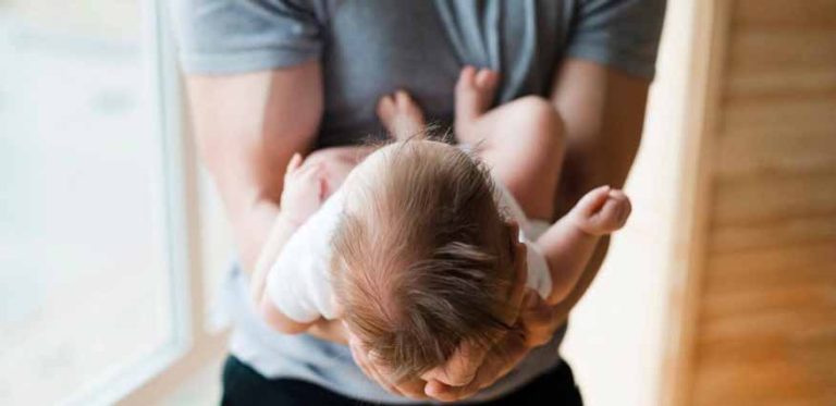 baby-bald-spots