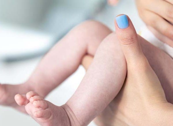 How can I soothe and relieve ITCHING in my baby’s skin?