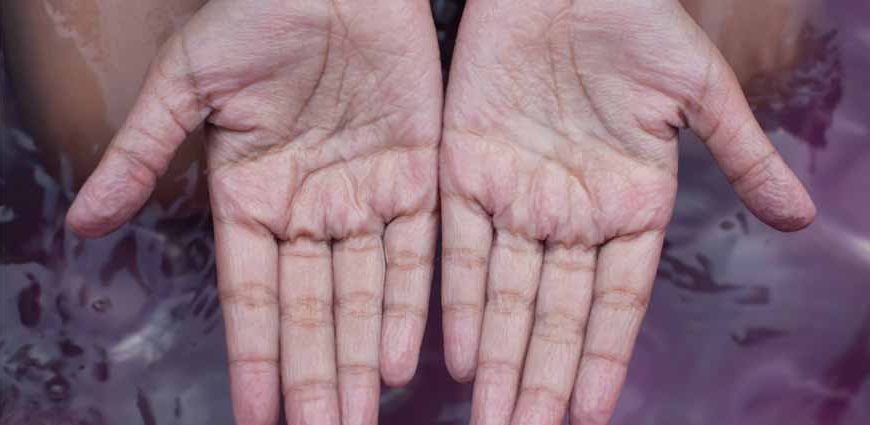 wrinkling-of-fingers-and-toes