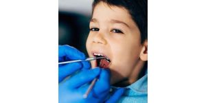 prevent-cavities