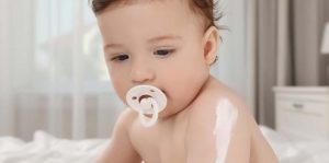 White Patches On Baby Skin Causes and Treatment
