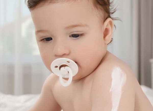 White Patches On Baby Skin: Causes and Treatment