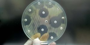 Photocells Overview Working, Uses & Key Concepts Explained